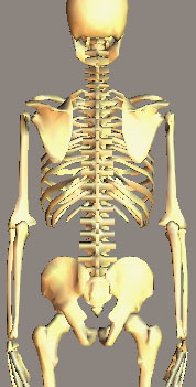 Scoliose acclre